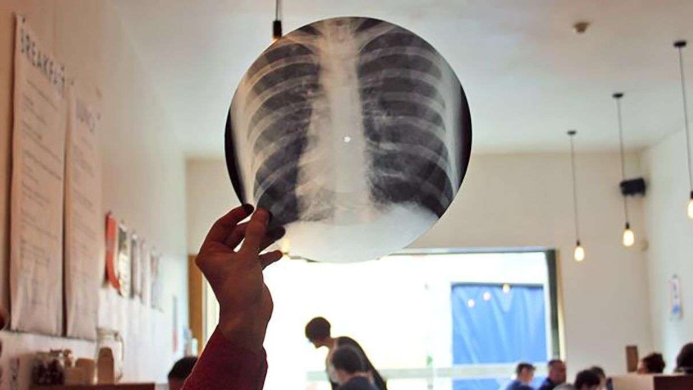 Soviet Ribcage X-Ray Record